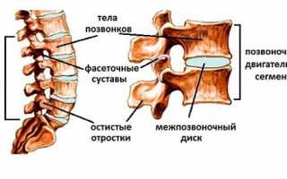 Особенности и лечение спондилоартроза поясничного отдела позвоночника