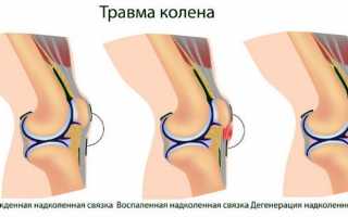 Почему отекает коленный сустав и как провести лечение?