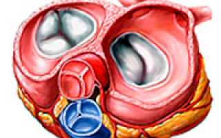 Пролапс митрального клапана противопоказания