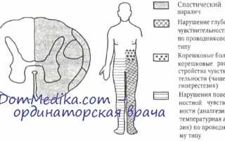 Синдром броун-секара