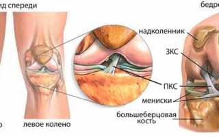 Почему возникает разрыв ПКС и как провести лечение?
