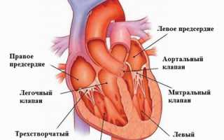 Пролапс митрального клапана у детей и подростков: что это такое и почему появляется?