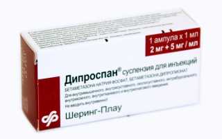 Выбираем лучшие инъекции при артрозе коленного сустава