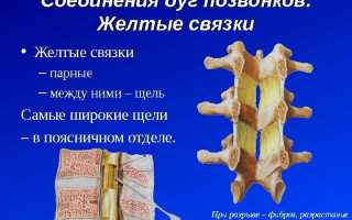Чем характеризует себя гипертрофия желтых связок позвоночника?