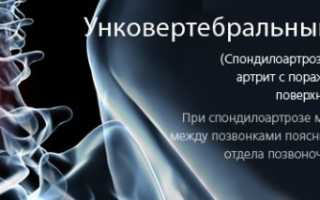 Что такое унковертебральный артроз  шейного отдела позвоночника