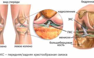 Как убрать жидкость из коленного сустава