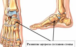 Симптомы и лечение болезней суставов ног