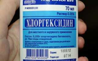 5 способов лечения ангины при беременности и ГВ