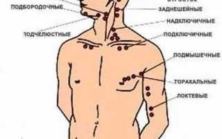 Почему воспаляются лимфоузлы – основные причины воспаления у мужчин и женщин