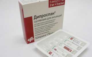 Опасны ли уколы Дипроспан, которые делают в сустав?