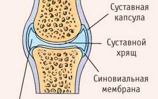 Как восстановить синовиальную жидкость?