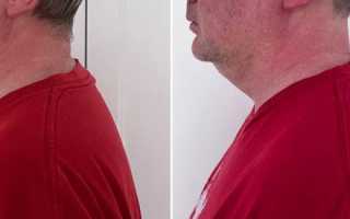 Синдром компьютерной шеи: эпидемия XXI века