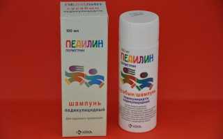 Как вывести вшей и гнид в домашних условиях?