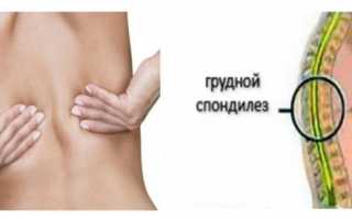 Как лечить спондилез поясничного и грудного отдела?