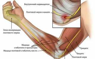 Что такое артрит локтевого сустава: симптомы и лечение