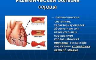 Как определить первые признаки ишемической болезни сердца