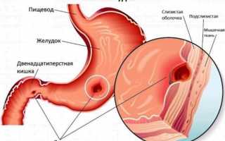 Почему ночью болит желудок – традиционные и нетрадиционные подходы к лечению