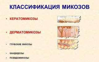 Классификация микозов кожи: симптомы и лечение