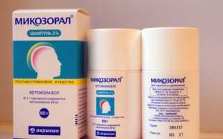 Причины белых пятен на коже и методы лечения