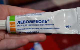 Причины фурункулеза на теле и методы его лечения