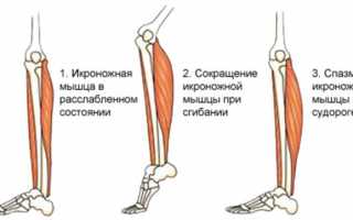 Что делать когда сводит ноги судорогой? Причины и методы лечения