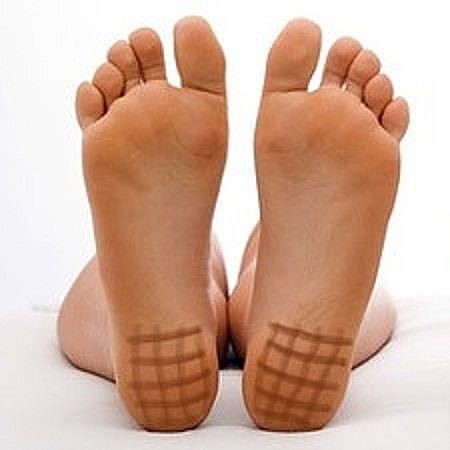 Йодовая сетка на стопах