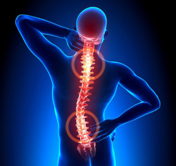 Причины возникновения протрузии позвоночника Протрузия позвоночника