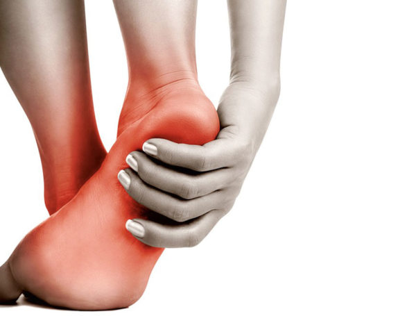 Причины возникновения бурсита пятки Бурсит пятки