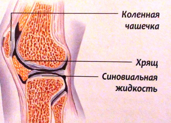 Синовиальная жидкость в колене