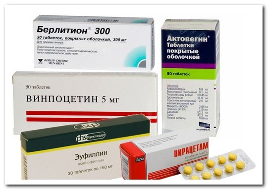 Нарушение мозгового кровообращения при шейном остеохондрозе