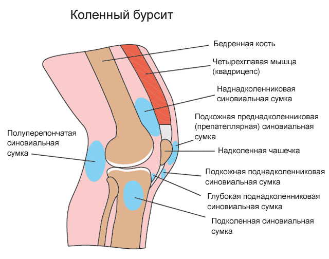 Суставная сумка