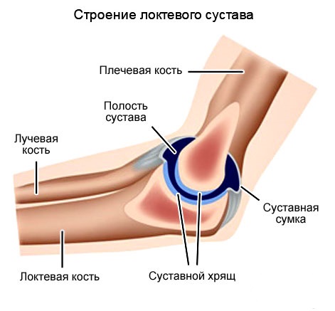Бурсит локтевого сустава
