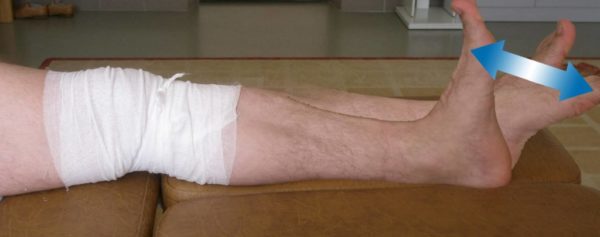 Гимнастика после эндопротезирования коленного сустава