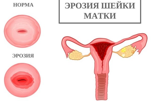 Болит поясница у женщин