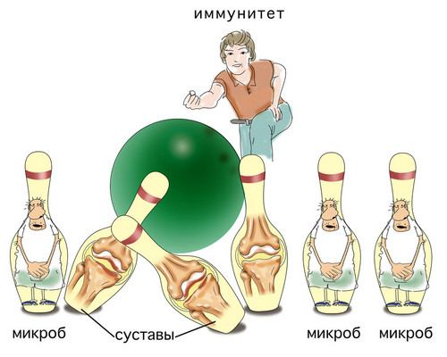 Воспаление суставов
