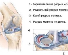 Схематическое изображение разрывов