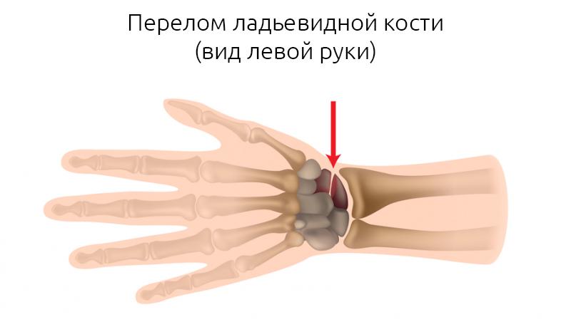 Рентген руки