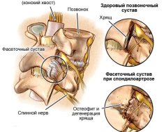 Подробное строение позвонков