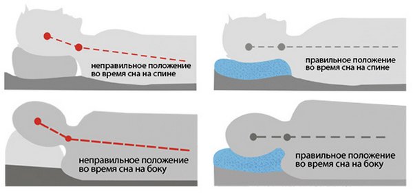 Правильно спать при остеохондрозе
