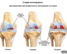 Стадии развития