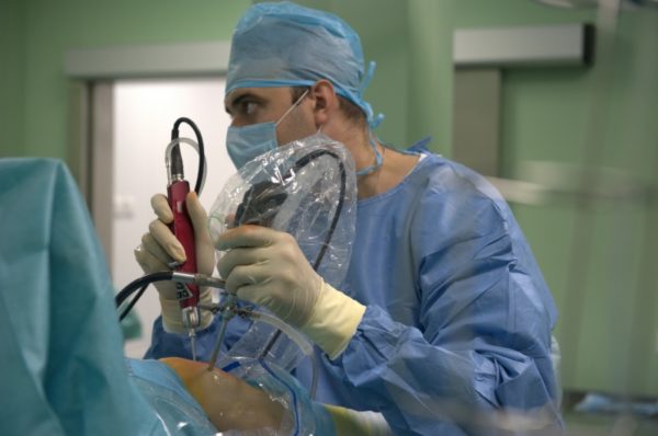 Разрыв медиального мениска: оперативное вмешательство Разрыв медиального мениска