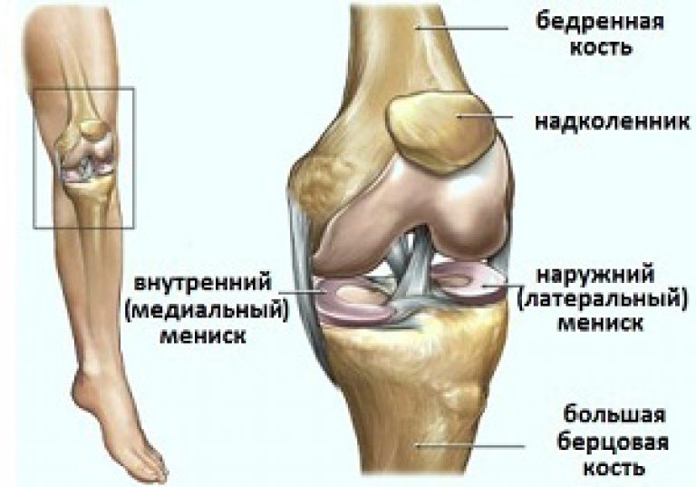 Мениск коленного сустава