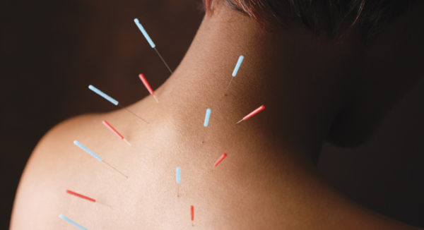 Показания к процедуре иглоукалывания Иглоукалывание