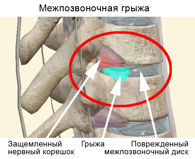 Дискус Композитум