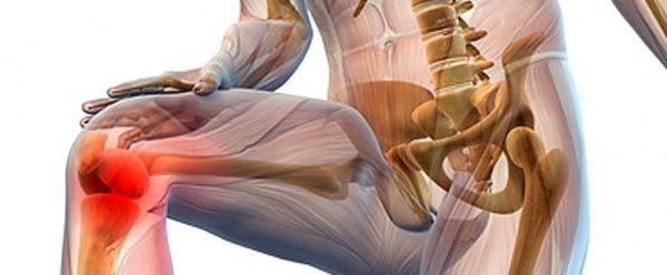 Ноет и болит колено при ходьбе Ноющая боль при ходьбе в коленной чашечке