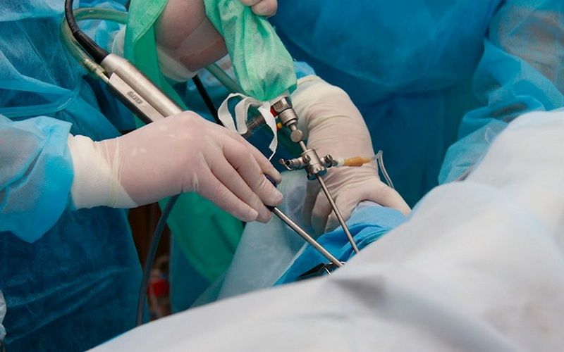 Артроскопия коленного сустава: инструменты для операции Артроскопия коленного сустава