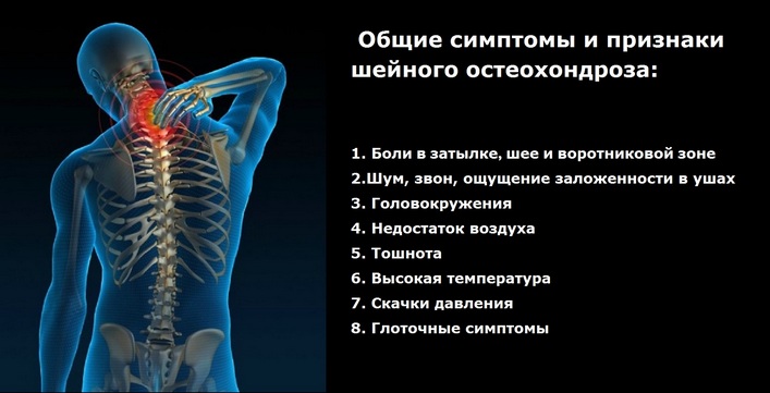 Артериальное давление при шейном остеохондрозе