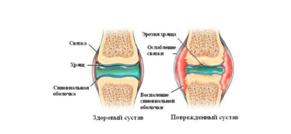 Суставная жидкость