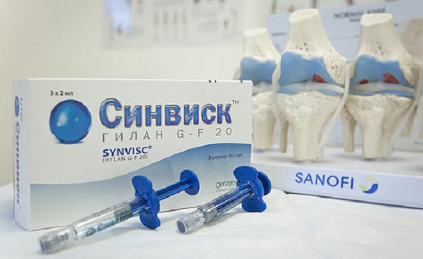 Уколы при артрозе коленного сустава