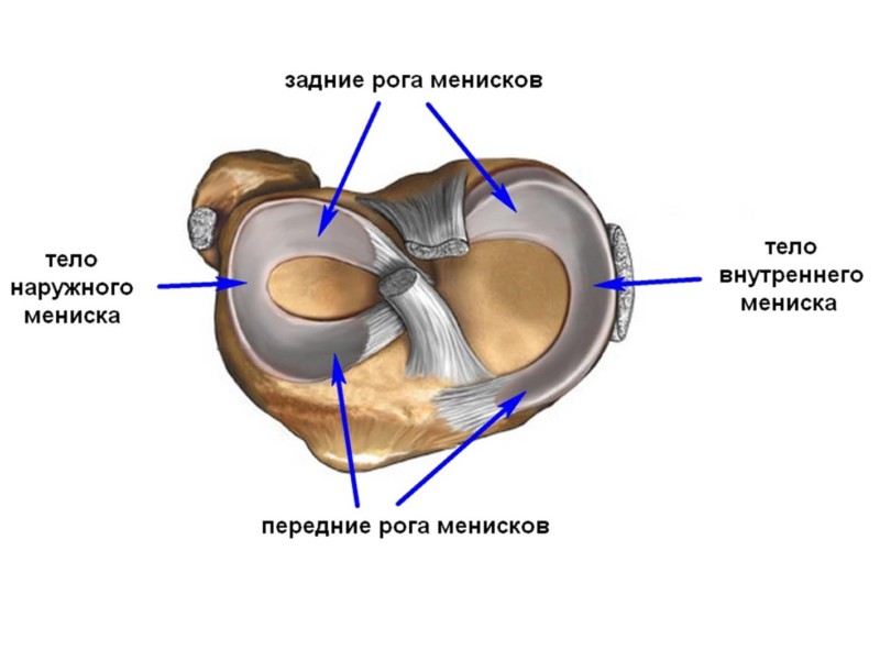 Мениск коленного сустава